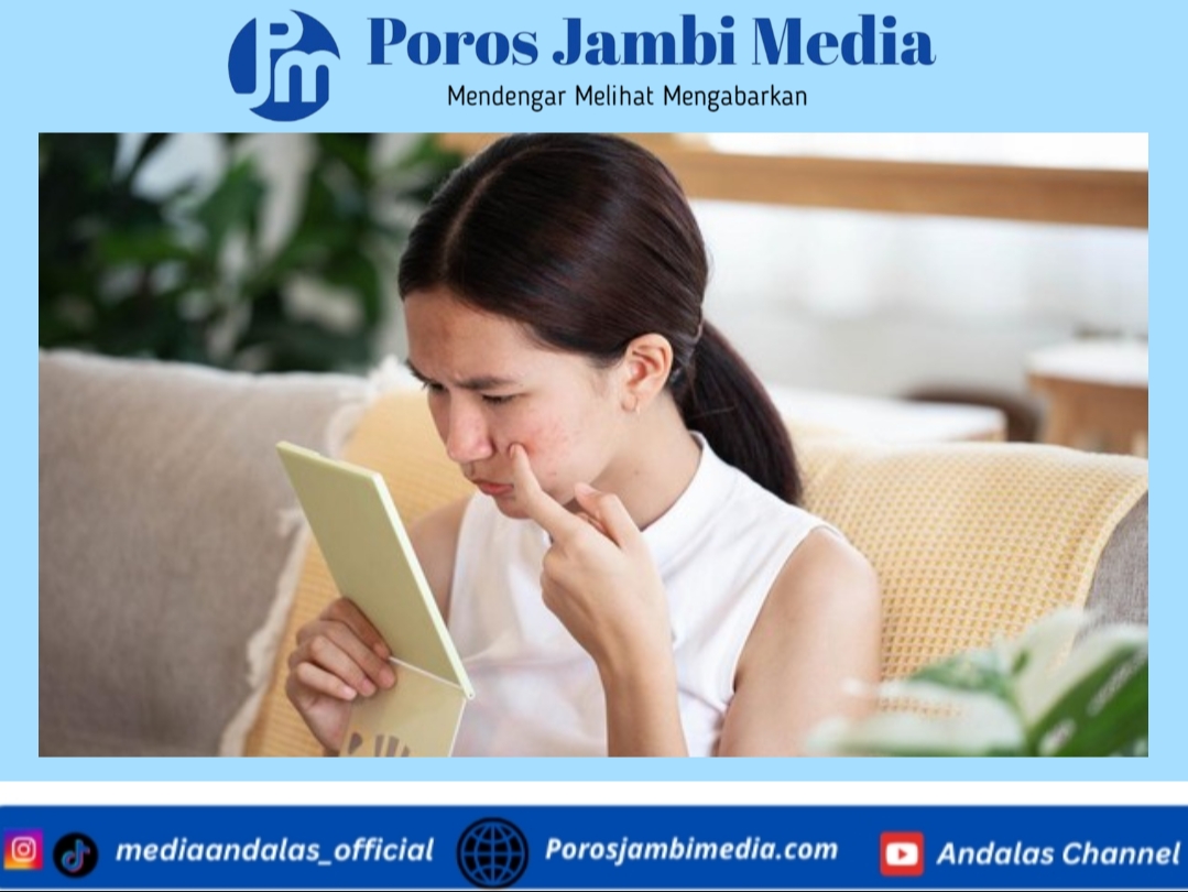 Jangan Sembarangan Memencet Jerawat di Area Ini, Dokter Ungkap Risikonya Bisa ke Otak Screenshot_2026-01-22-22-04-48-56_dba69a5e82e939c3ddef13f99a115ca3